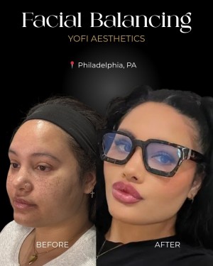 Yofi Med Spa